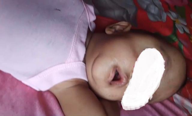 IMG-20260713-WA0012_resize_92 Pemkab beserta DPRD Madina menggalang donasi untuk pengobatan anak mengidap kanker mata yang dirawat di RS M Jamil Padang.